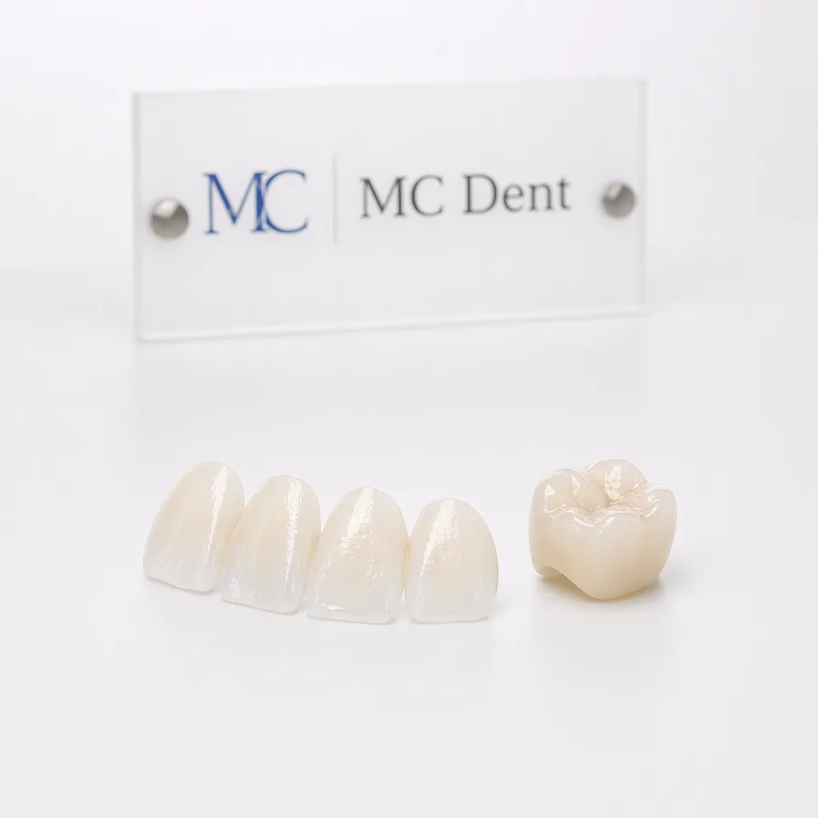 Lentes e coroas E-Max sobre mesa branca com placa MC Dent